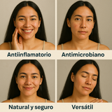 NUEVO ACEITE DE COPAIBA - Poderoso Antiinflamatorio y Antimicrobiano Natural