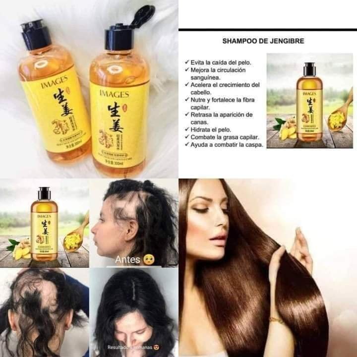 NUEVO SHAMPOO DE GENGIBRE - EVITA LA CAÍDA DE CABELLO