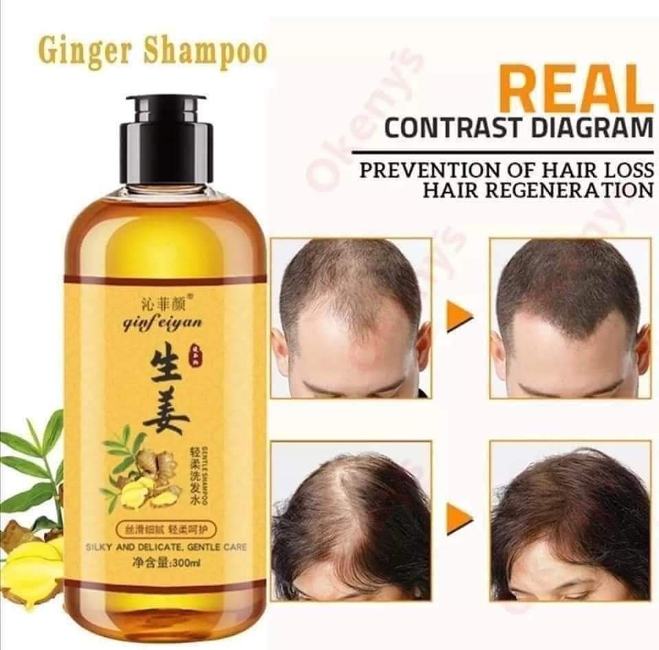 NUEVO SHAMPOO DE GENGIBRE - EVITA LA CAÍDA DE CABELLO